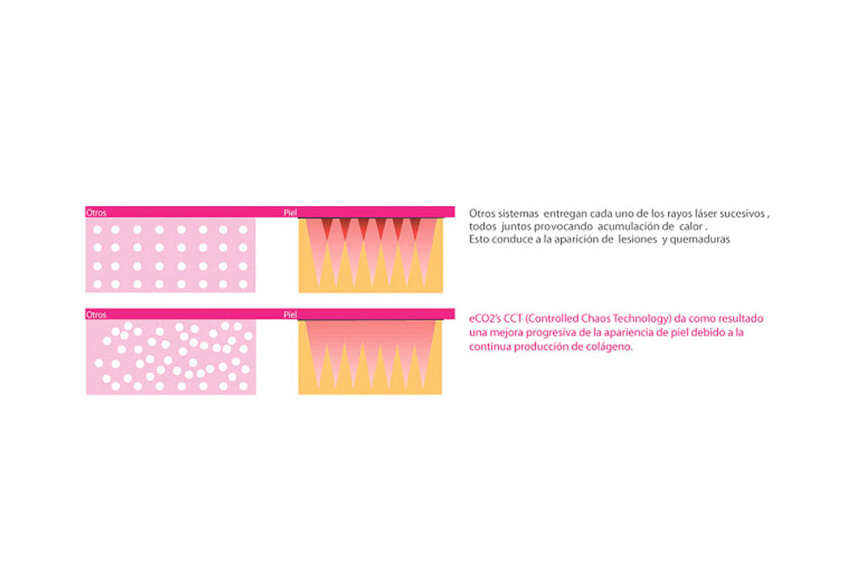Laser multifraccional eCO2